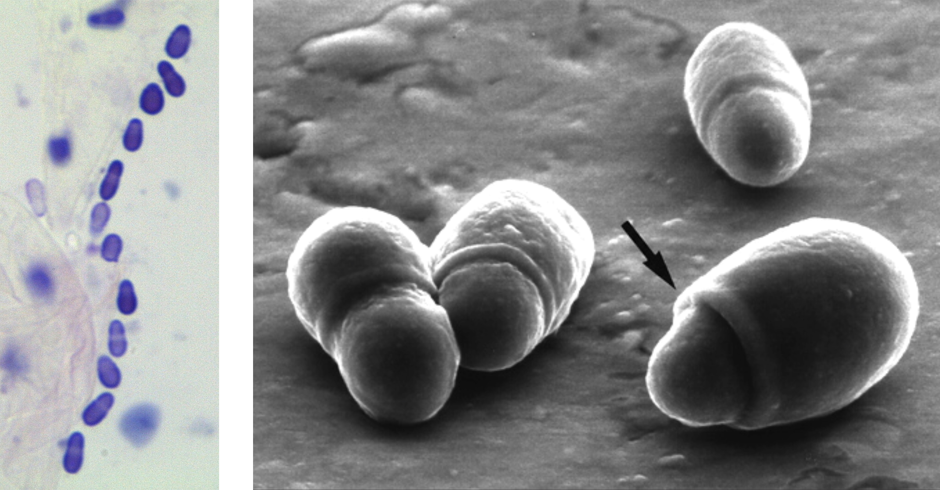 Malassezia-MEB-Guillot_2